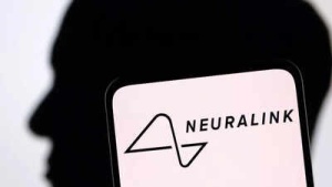 Neuralink's Brain Implant to Decode Thoughts into Text: Landmark Trial Offers Hope for Speech-Impaired